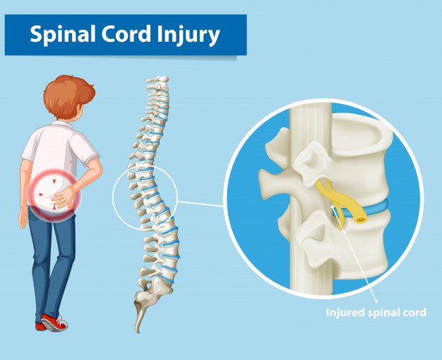 diagram showing spinal cord injury - دروس الفوتوشوب Photoshop tutorials